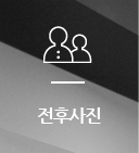 전후사진