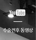 수술전후 동영상