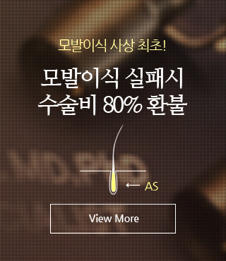 모발이식 실패시 수술비 80% 환뷸