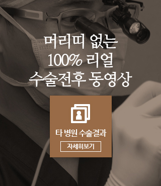 머리띠 없는 10% 리얼 수술 전후 동영상
