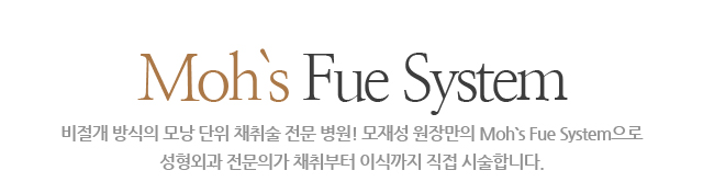 moh's fue system