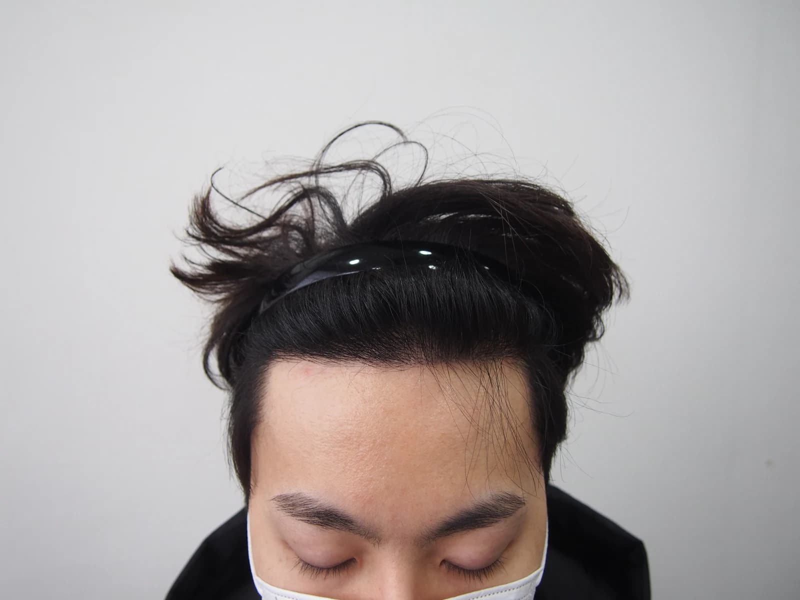 수술 후 사진
