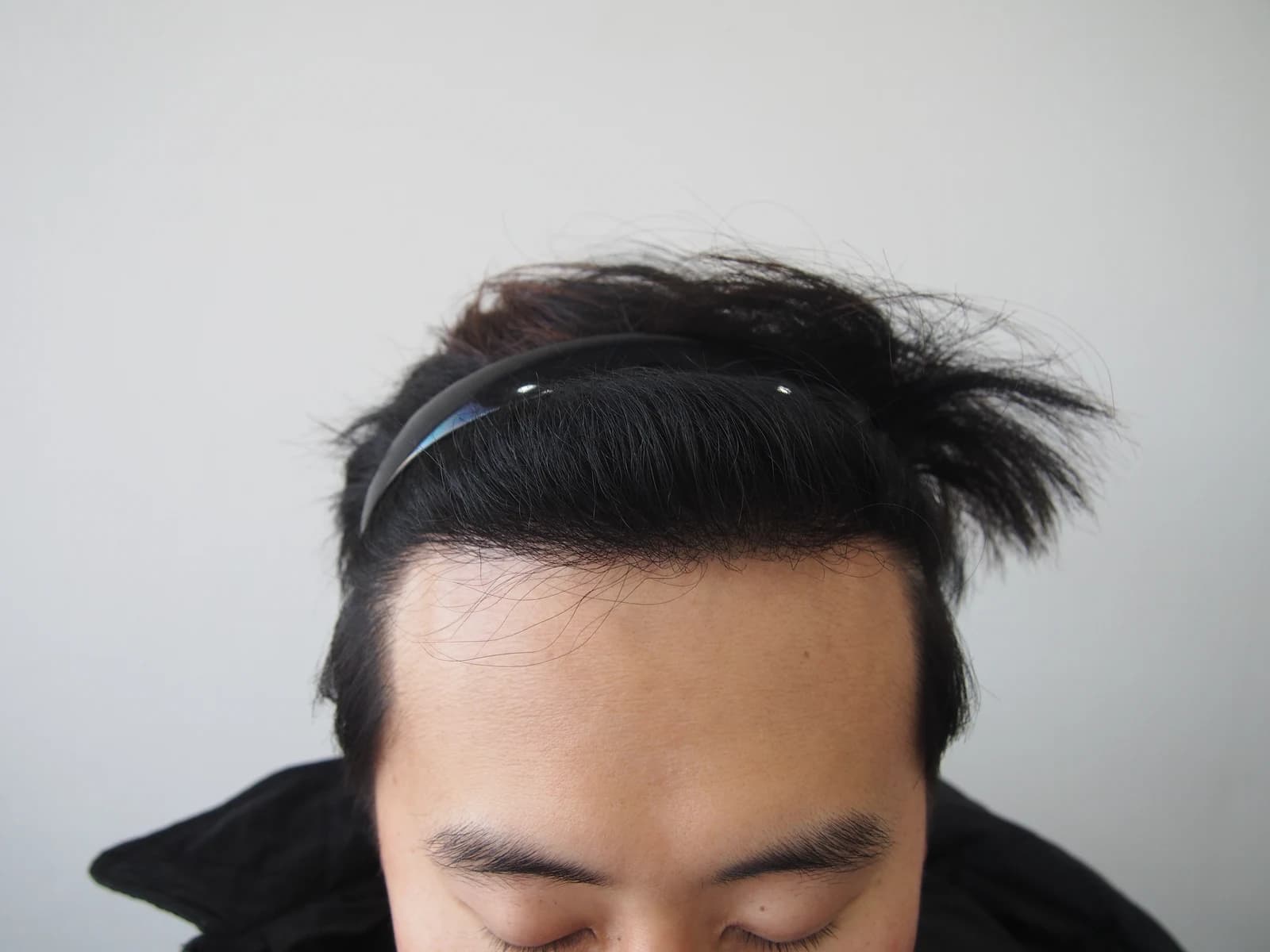 수술 후 사진