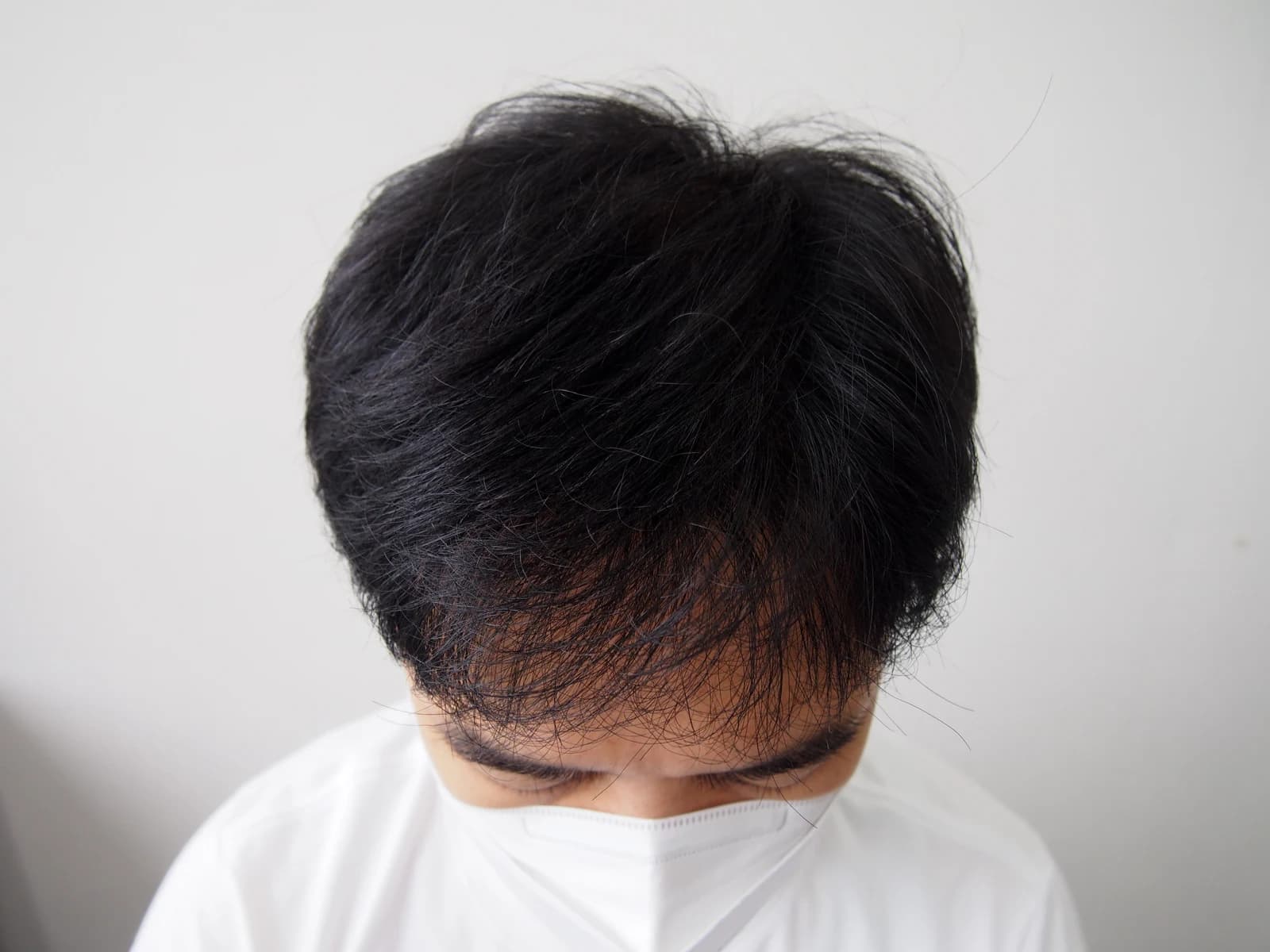 수술 후 사진