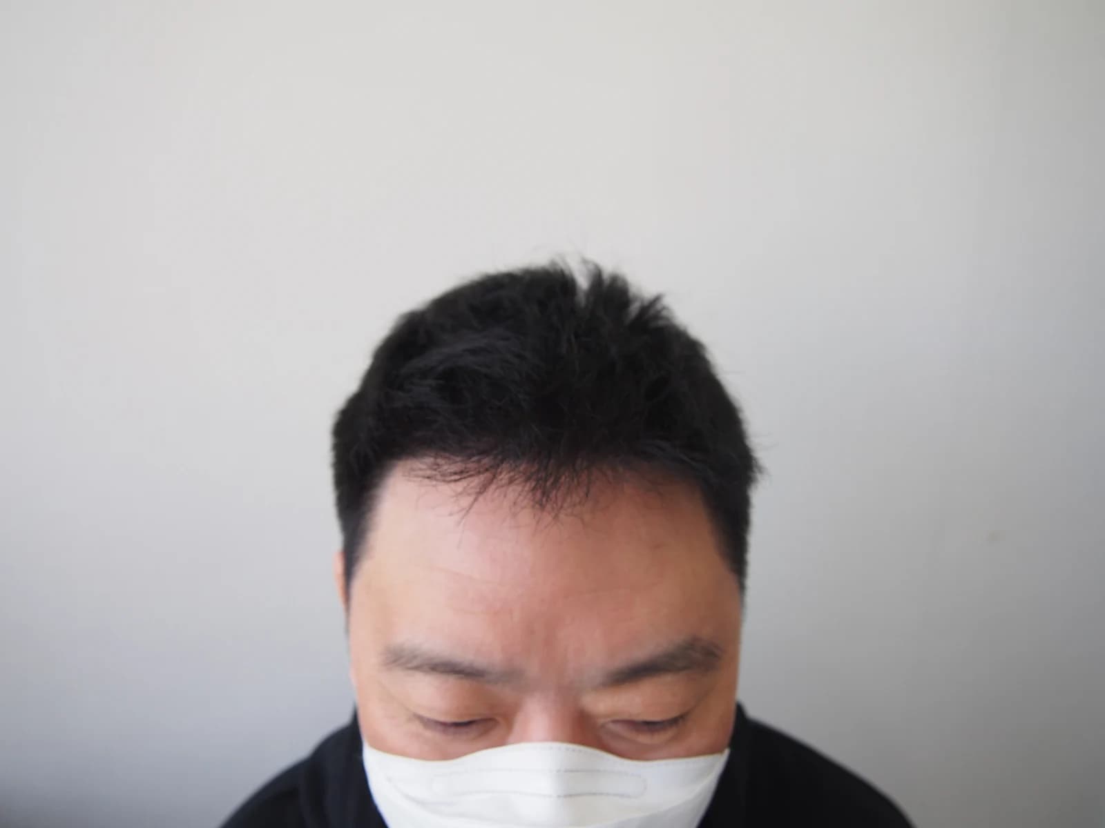 수술 후 사진
