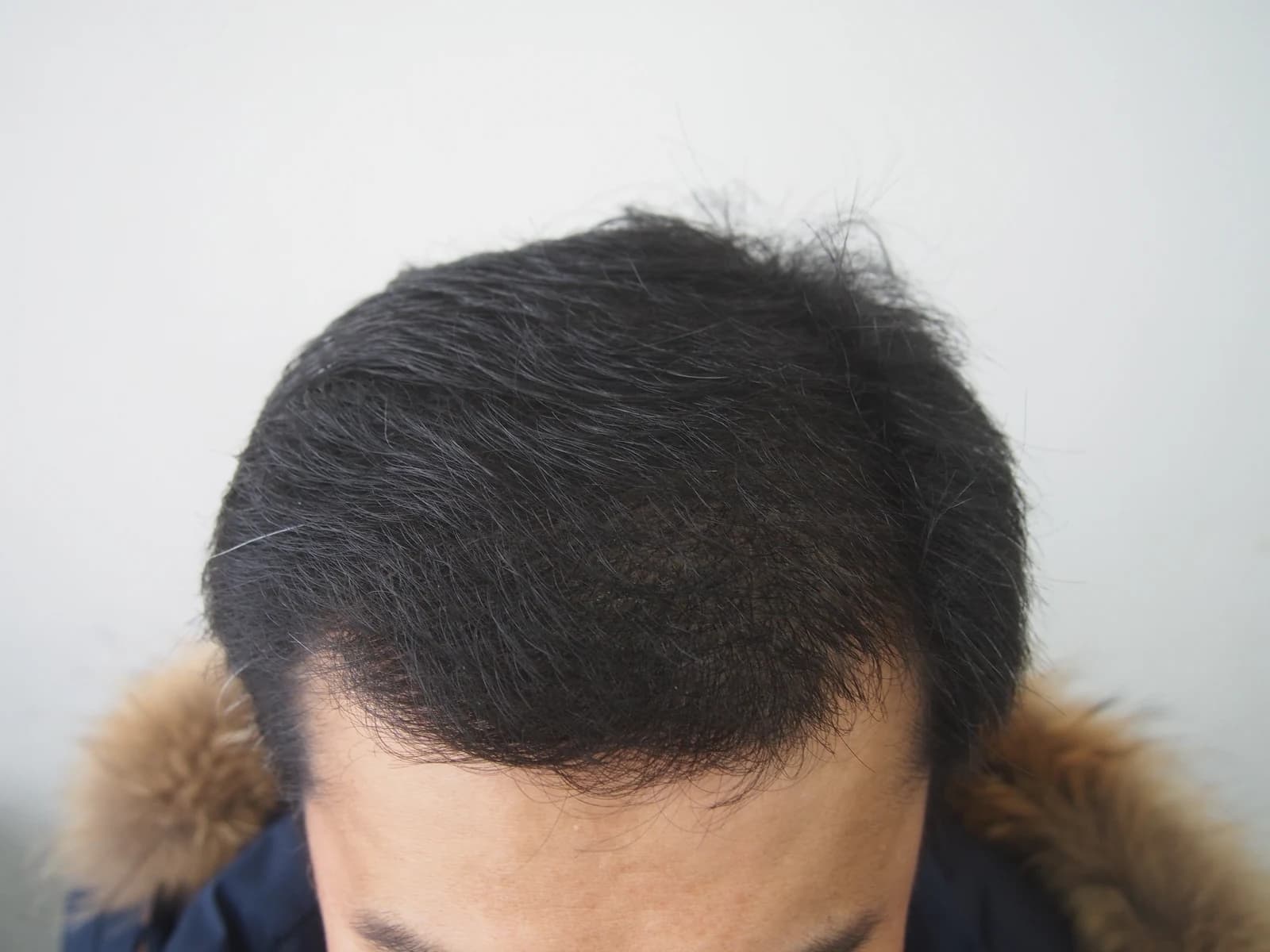 수술 후 사진