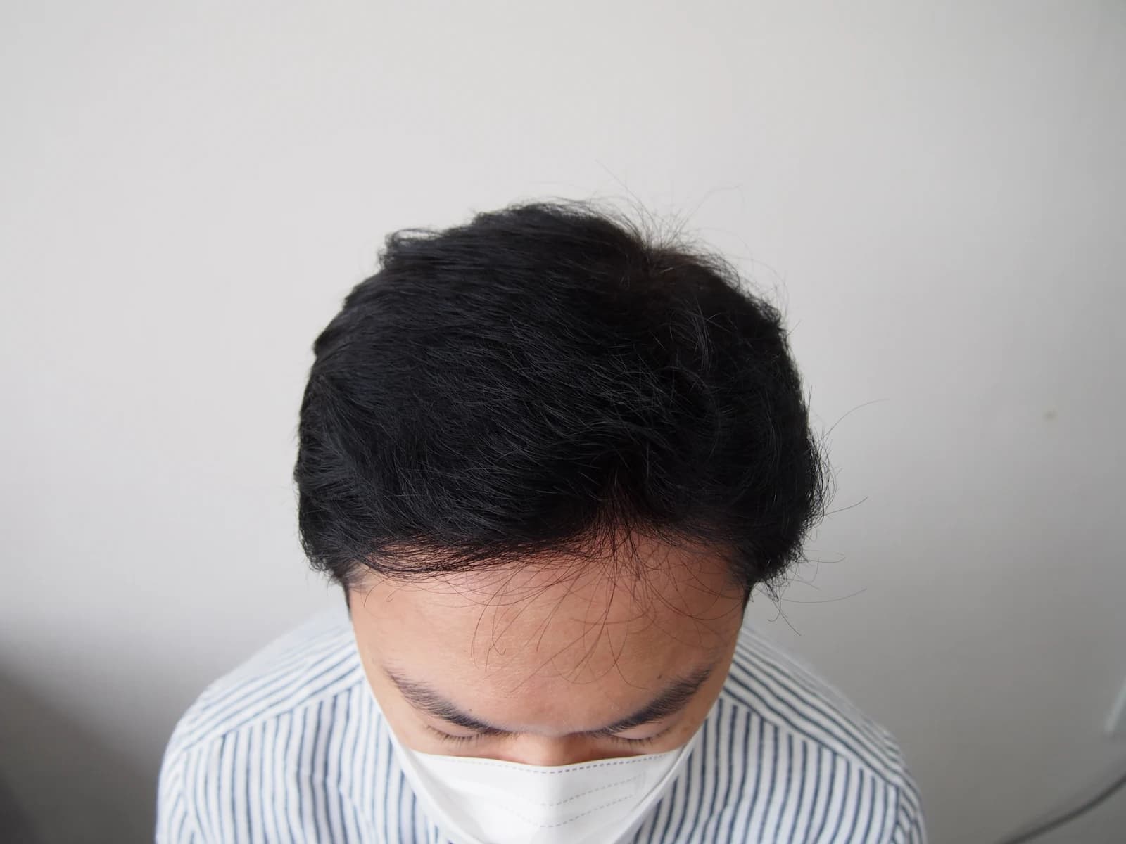 수술 후 사진