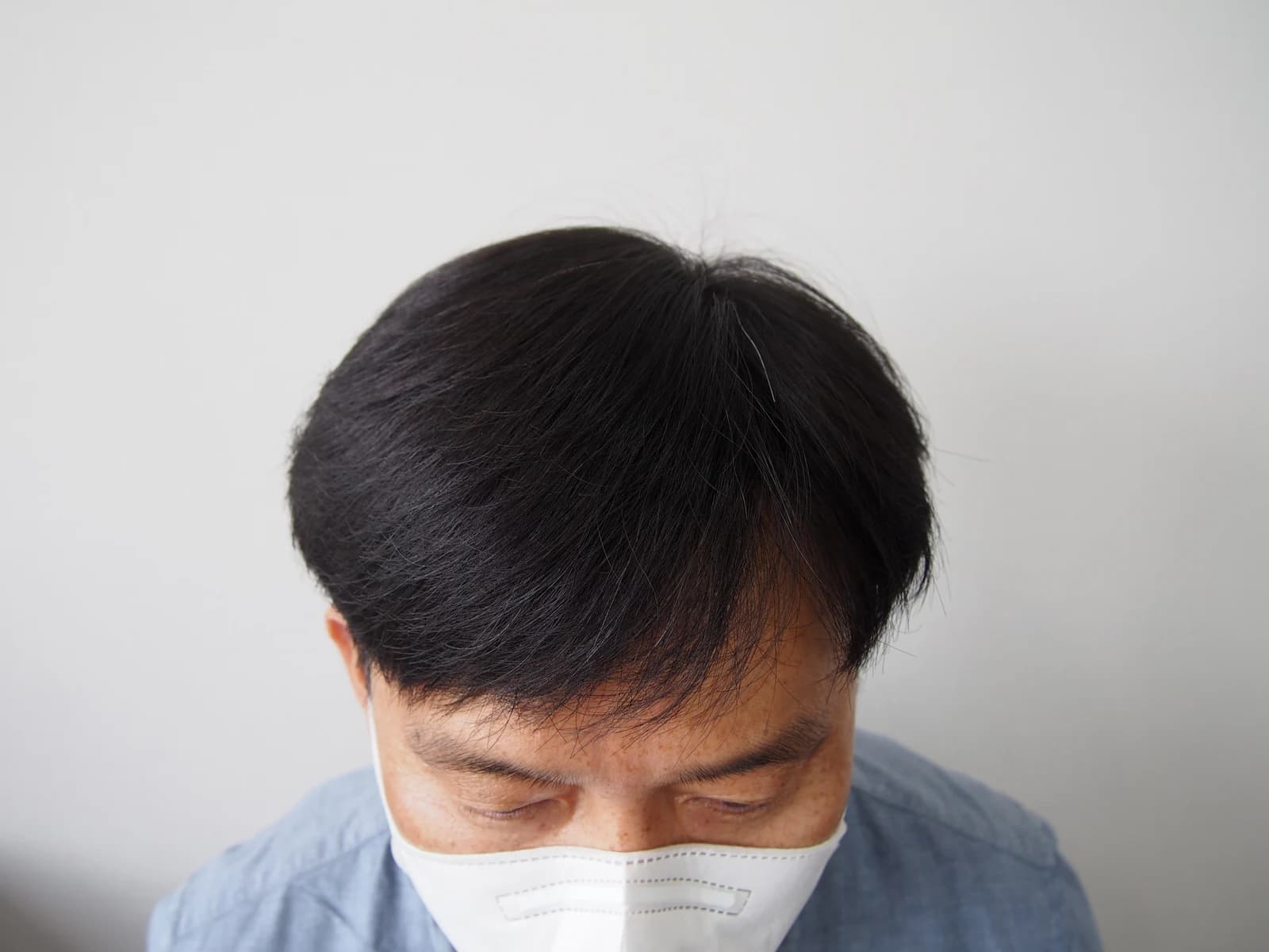 수술 후 사진