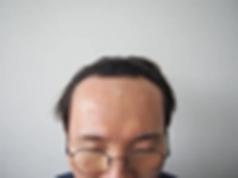 수술 전 사진의 열람 제한 미리보기