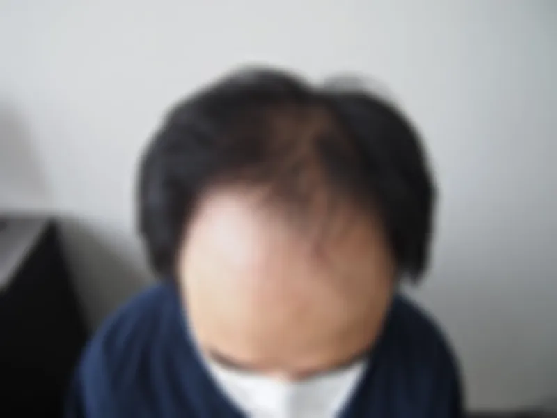 수술 전 사진의 열람 제한 미리보기
