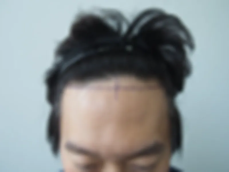 수술 전 사진의 열람 제한 미리보기