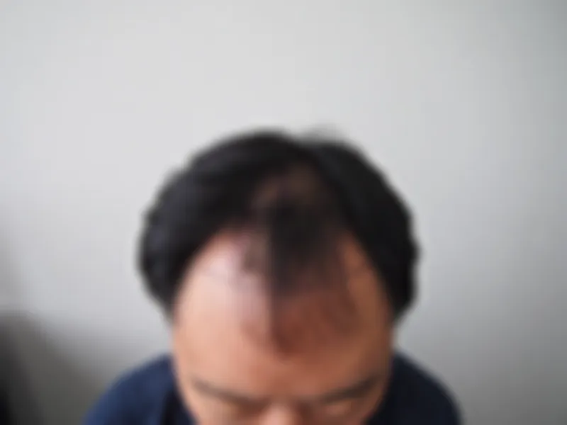 수술 전 사진의 열람 제한 미리보기