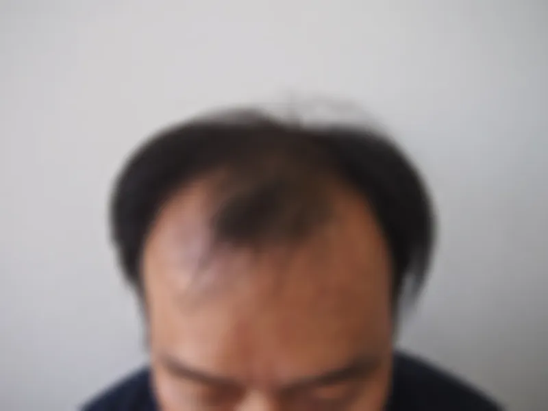 수술 전 사진의 열람 제한 미리보기