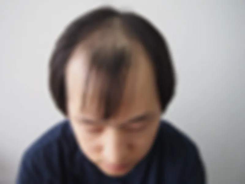 수술 전 사진의 열람 제한 미리보기